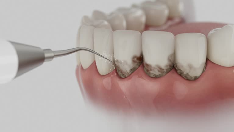 Reliable Dental Implants contractor in Three Points, AZ by Smile Center Dentistry